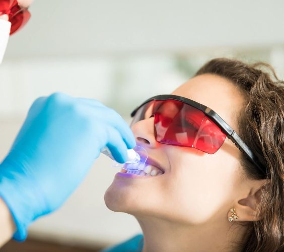 Teeth Whitening & Bleaching Teeth Whitening & Bleaching